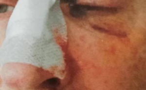 Denuncian una agresi&oacute;n a un funcionario de la prisi&oacute;n de Asturias que tuvo que salir en ambulancia