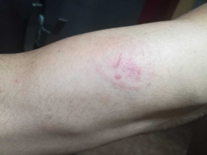 Denuncian la agresi&oacute;n de un interno a tres funcionarios de la c&aacute;rcel de Ja&eacute;n con patadas, pu&ntilde;etazos y mordiscos